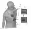 Fig. 01 - Integrated vectorcardiogram system and method of use