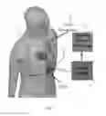 Fig. 03 - Integrated vectorcardiogram system and method of use