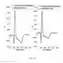 Fig. 19 - Integrated vectorcardiogram system and method of use
