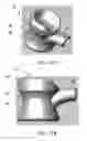 Fig. 16 - Systems and methods for measuring oxygenation