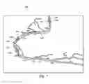 Fig. 08 - Devices, systems, and methods and associated display screens for assessment of vessels with multiple sensing components