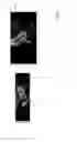 Fig. 08 - Systems and methods for emulating DEXA scores based on CT images