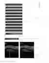 Fig. 14 - Systems and methods for emulating DEXA scores based on CT images