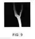 Fig. 10 - MEDICAL IMAGE PROCESSING APPARATUS, X-RAY DIAGNOSTIC APPARATUS, MEDICAL IMAGE PROCESSING METHOD AND X-RAY DIAGNOSTIC METHOD