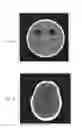 Fig. 06 - Brain tissue equivalent material and phantom device comprising the same