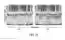 Fig. 14 - Lung sound denoising stethoscope, algorithm, and related methods