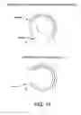 Fig. 15 - Method and apparatus for distracting a joint