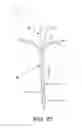 Fig. 23 - Method and apparatus for distracting a joint