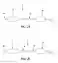 Fig. 26 - Method and apparatus for distracting a joint