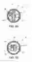 Fig. 31 - Method and apparatus for distracting a joint