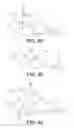 Fig. 35 - Method and apparatus for distracting a joint