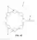 Fig. 37 - Method and apparatus for distracting a joint