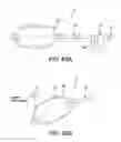 Fig. 43 - Method and apparatus for distracting a joint