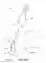 Fig. 45 - Method and apparatus for distracting a joint