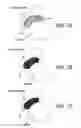 Fig. 52 - Method and apparatus for distracting a joint
