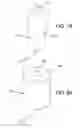 Fig. 54 - Method and apparatus for distracting a joint