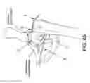 Fig. 58 - Method and apparatus for distracting a joint