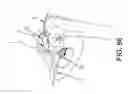 Fig. 59 - Method and apparatus for distracting a joint