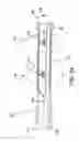 Fig. 67 - Method and apparatus for distracting a joint