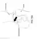 Fig. 76 - Method and apparatus for distracting a joint