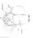 Fig. 80 - Method and apparatus for distracting a joint