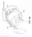 Fig. 81 - Method and apparatus for distracting a joint