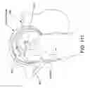 Fig. 84 - Method and apparatus for distracting a joint