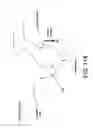 Fig. 87 - Method and apparatus for distracting a joint