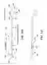 Fig. 93 - Method and apparatus for distracting a joint