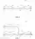 Fig. 04 - Mechanical retraction via tethering for lung volume reduction