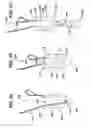 Fig. 04 - Suture management system
