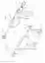 Fig. 12 - Arthroscopic surgical device