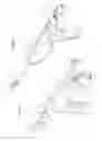 Fig. 15 - Arthroscopic surgical device