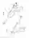 Fig. 17 - Arthroscopic surgical device
