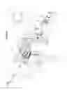 Fig. 20 - Arthroscopic surgical device