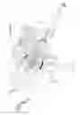 Fig. 21 - Arthroscopic surgical device
