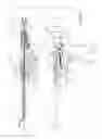 Fig. 53 - Arthroscopic surgical device