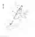 Fig. 59 - Arthroscopic surgical device