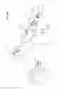 Fig. 62 - Arthroscopic surgical device