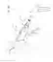 Fig. 63 - Arthroscopic surgical device