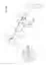 Fig. 64 - Arthroscopic surgical device