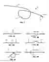 Fig. 02 - METHODS AND SYSTEMS FOR ADVANCING AND ANCHORING SUTURE IN TISSUE