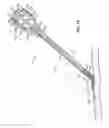 Fig. 07 - METHODS AND SYSTEMS FOR ADVANCING AND ANCHORING SUTURE IN TISSUE