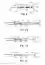 Fig. 04 - Methods and Devices for Controlling the Size of Emphysematous Bullae