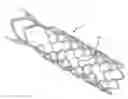 Fig. 01 - METHODS AND DEVICES FOR TREATMENT OF VASCULAR DEFECTS