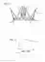 Fig. 09 - METHODS AND DEVICES FOR TREATMENT OF VASCULAR DEFECTS
