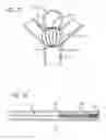 Fig. 15 - METHODS AND DEVICES FOR TREATMENT OF VASCULAR DEFECTS