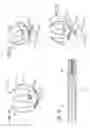 Fig. 17 - METHODS AND DEVICES FOR TREATMENT OF VASCULAR DEFECTS