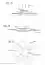 Fig. 28 - METHODS AND DEVICES FOR TREATMENT OF VASCULAR DEFECTS