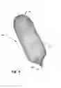 Fig. 05 - Occluder for occluding an atrial appendage and production process therefor